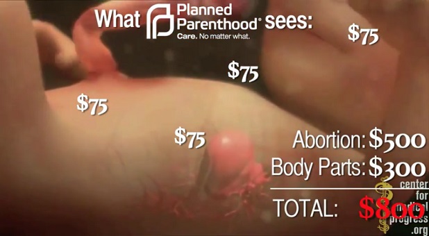 Planned Parenthood Faces Allegations From Former Clinic Worker in Graphic New Video