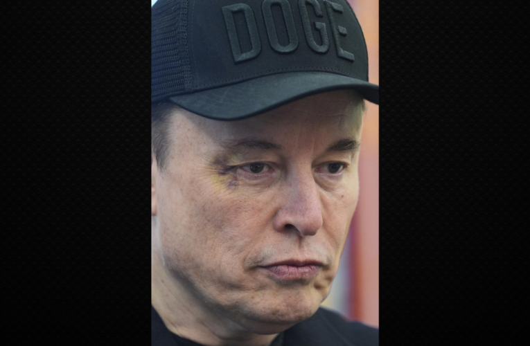 Fight, Mishap or Warning? Elon Musk’s Black Eye Fuels Theories